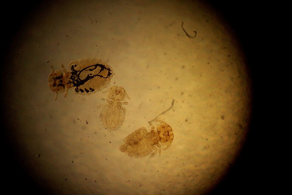 Photo of Dog louse